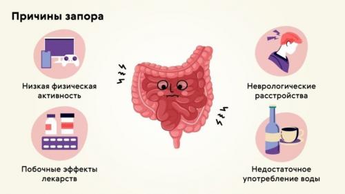 Можно ли делать клизму при запоре. Причины и симптомы