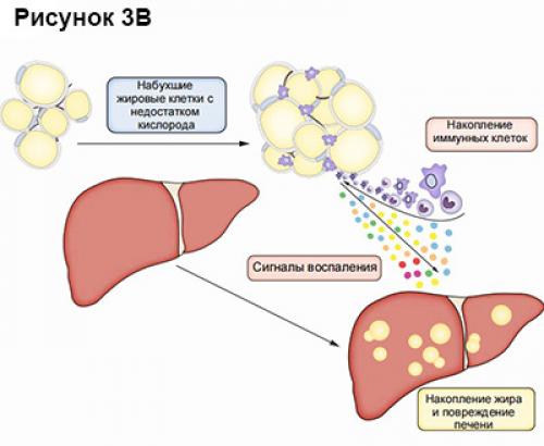 Что еще вызывает ожирение печени. Определение болезни. Причины заболевания 06 Что еще вызывает ожирение печени. Определение болезни. Причины заболевания 06