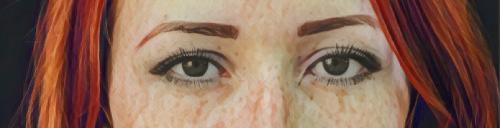 Мазь от гранулемы пирсинга. Места локализации и причины развития пиогенной гранулемы