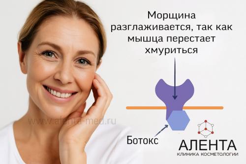 Какие возможные осложнения после введения ботокса в лоб и межбровье. Последствия уколы ботокса в лоб. Вредно ли делать ботокс в лоб? Чем опасен ботокс?