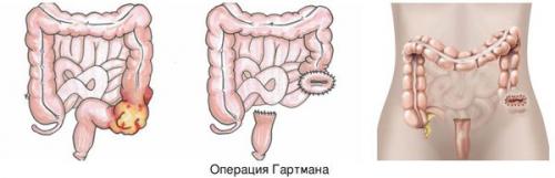 Почему ухаживать за кожей после ботулинотерапии: важные рекомендации 01 Почему ухаживать за кожей после ботулинотерапии: важные рекомендации 01