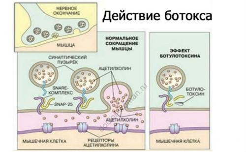 Чувствуются ли результаты ботокса сразу после процедуры или требуется время. Когда начинает действовать Ботокс и какими процессами объясняется его эффект