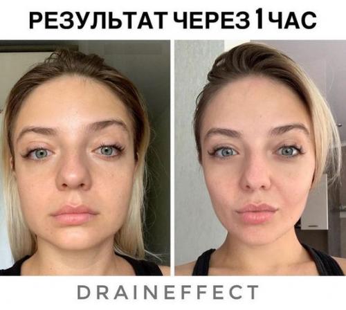 Аптечный аналог драйнэффект. Draineffect (Драйнэффект) напиток от отеков и для похудения
