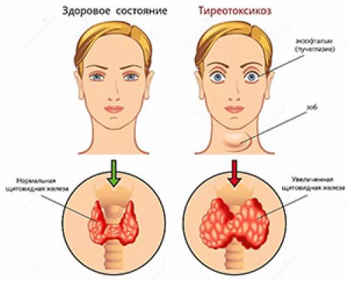 Функции и гормоны щитовидной железы. Гормоны щитовидной железы ( T3, T4, кальцитонин) : их образование, транспорт, метаболизм и регуляция через ТТГ. Йод в организме человека 01