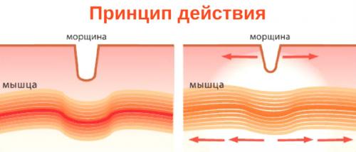 Ботокс вреден для организма. Косметические процедуры 01 Ботокс вреден для организма. Косметические процедуры 01