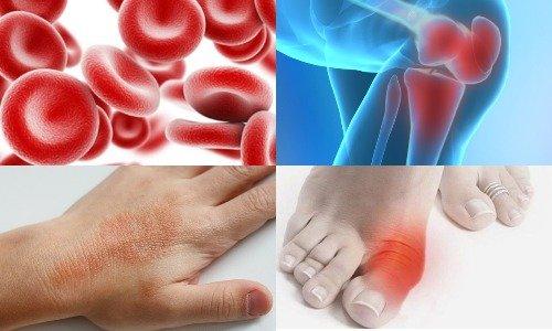 Овес для очищения организма. Лечебные свойства овса 06 Овес для очищения организма. Лечебные свойства овса 06