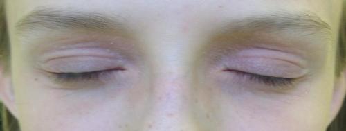 Сухая кожа под глазами морщины, что делать. Причины, по которым кожа лица становится дряблой 01 Сухая кожа под глазами морщины, что делать. Причины, по которым кожа лица становится дряблой 01