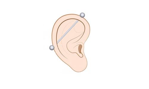 Прокол ушей, как можно сделать. Все виды пирсинга уха