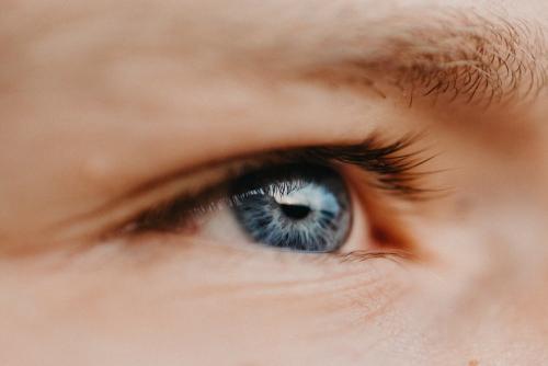 Морщины под глазами в 30 почему появляются и как убрать. Как убрать морщины вокруг глаз 02