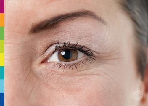 Морщины вокруг глаз, как убрать. Все способы избавиться от морщин вокруг глаз 03