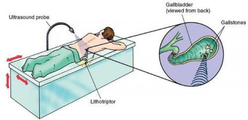 Диета при больной поджелудочной железе. Особенности диеты при панкреатите поджелудочной железы 01 Диета при больной поджелудочной железе. Особенности диеты при панкреатите поджелудочной железы 01