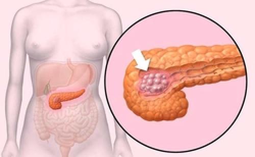 Новые технологии в борьбе с ожирением: современные подходы к лечению 02 Новые технологии в борьбе с ожирением: современные подходы к лечению 02