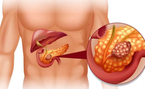 Новые технологии в борьбе с ожирением: современные подходы к лечению 03 Новые технологии в борьбе с ожирением: современные подходы к лечению 03