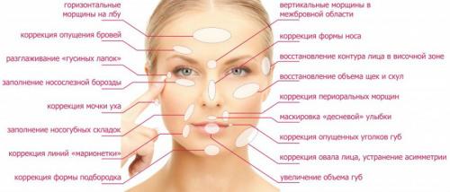 Ботокс для лица последствия. Ботулинотерапия в косметологии 03 Ботокс для лица последствия. Ботулинотерапия в косметологии 03