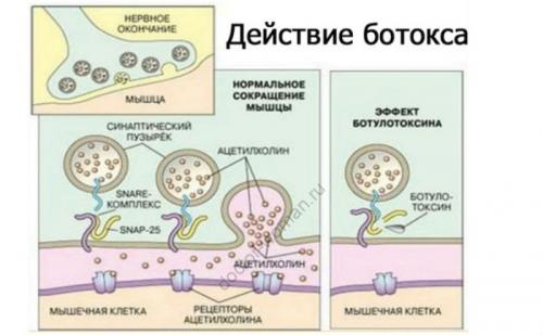 Как долго длится эффект после процедуры уколов в лоб от морщин. Когда начинает действовать Ботокс и какими процессами объясняется его эффект