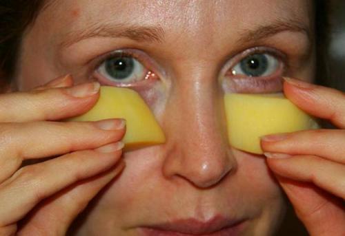 Средство от темных кругов под глазами в домашних условиях. Темные круги под глазами —, как избавиться в домашних условиях