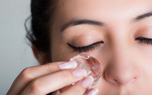 Как убрать синяки под глазами в домашних условиях. Причины появления синяков под глазами 13 Как убрать синяки под глазами в домашних условиях. Причины появления синяков под глазами 13