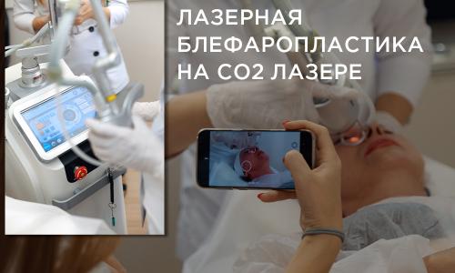 Каковы преимущества лазерной терапии по сравнению с другими методами удаления тёмных кругов под глазами. Лазерная блефаропластика на СО2 лазере