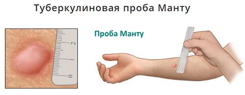 Какие факторы могут способствовать появлению папул. Общие сведения