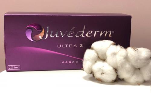 Носогубные складки коррекция. Удаление носогубных складок на лице