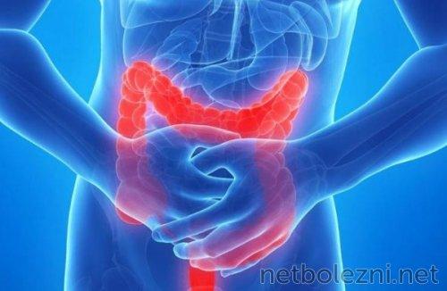 Простой способ очистить кишечник дома за один день 03