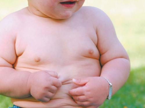 Лишний вес у ребенка. Алиментарный тип ожирения, гены и болезни бабушек 03 Лишний вес у ребенка. Алиментарный тип ожирения, гены и болезни бабушек 03
