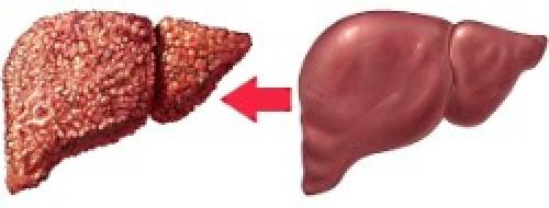 Можно ли использовать диету на основе кефира для очищения кишечника и печени в качестве части ежедневного рациона. Можно ли пить кефир при болезнях печени?
