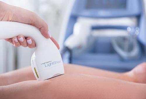 Надо ли бриться перед лазерной эпиляцией. Зачем брить волосы перед лазерной эпиляцией 01