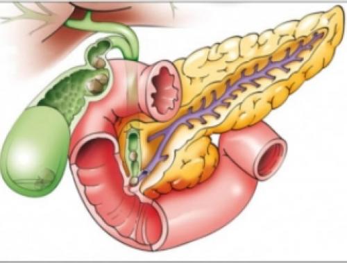 Рецепты блюд диеты при остром и хроническом панкреатите. Зачем соблюдать диету 04