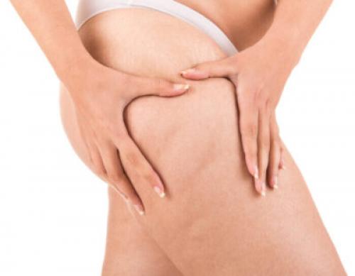 Обертывание для похудения ляшек в домашних условиях. Как избавиться от целлюлита на бедрах и ягодицах