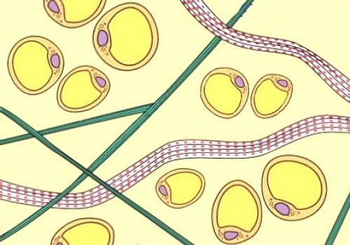 Что такое целлюлит простыми словами. Что такое целлюлит?