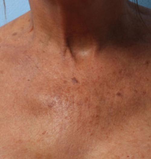 Обертывания для молодости кожи. Косметические обертывания для молодости и упругости кожи 07 Обертывания для молодости кожи. Косметические обертывания для молодости и упругости кожи 07