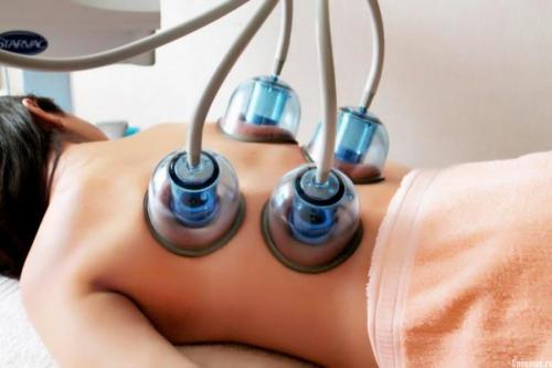 Баночный массаж против целлюлита. Как ставить банки: главные правила 04