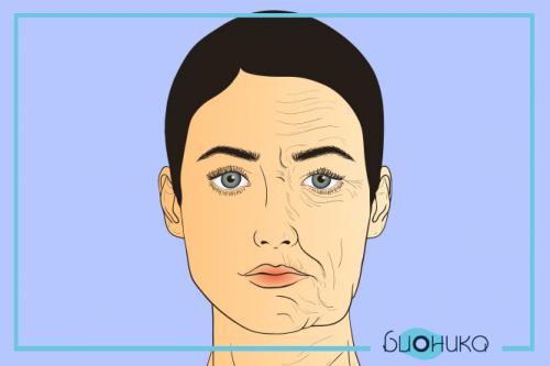 Когда эффект от Ботокса. Плюсы и минусы применения в косметологии 01 Когда эффект от Ботокса. Плюсы и минусы применения в косметологии 01