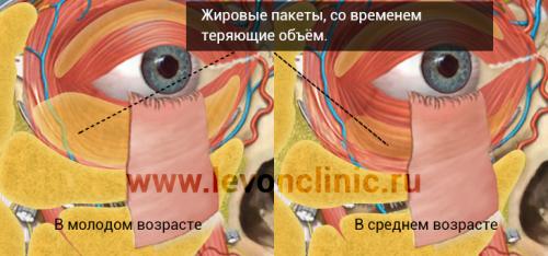 Как убрать тёмные круги под глазами. Косметологические методы избавления от тёмных кругов под глазами 10 Как убрать тёмные круги под глазами. Косметологические методы избавления от тёмных кругов под глазами 10