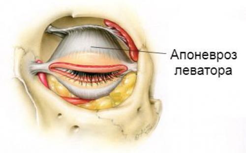 Гравитационный птоз нижней трети лица и верхнего века. Определение болезни. Причины заболевания 01