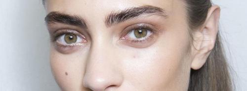 Как убрать тёмные круги под глазами. Косметологические методы избавления от тёмных кругов под глазами 04 Как убрать тёмные круги под глазами. Косметологические методы избавления от тёмных кругов под глазами 04