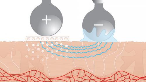 Какие ощущения возникают во время и после процедуры. Как работает косметическая процедура