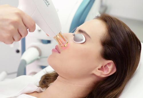 Как убрать морщины-марионетки упражнения. Методы борьбы