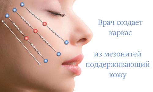 Как убрать морщины-марионетки упражнения. Методы борьбы