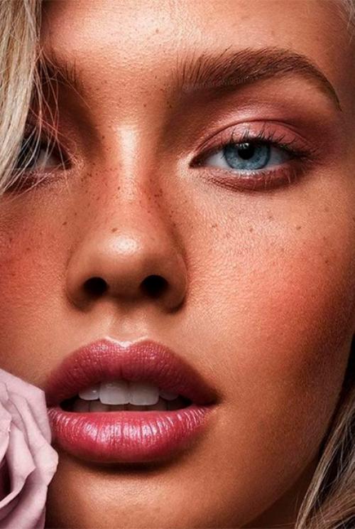 Как убрать морщины-марионетки филлерами 02 Как убрать морщины-марионетки филлерами 02