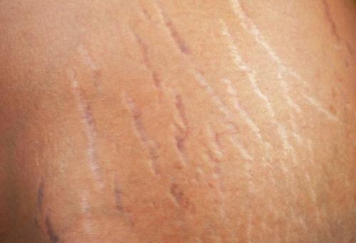 Как помочь похудеть толстому ребенку. Что я могу сделать для ребенка, чтобы предотвратить нездоровый лишний вес и ожирение? 03 Как помочь похудеть толстому ребенку. Что я могу сделать для ребенка, чтобы предотвратить нездоровый лишний вес и ожирение? 03